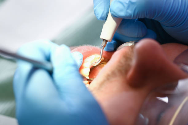 Best Emergency Care for Gum Disease in Mount Rainier, MD